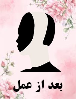 بعد از عمل